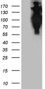 APBB1 / FE65 Antibody - HEK293T cells were transfected with the pCMV6-ENTRY control. (Left lane) or pCMV6-ENTRY APBB1. (Right lane) cDNA for 48 hrs and lysed. Equivalent amounts of cell lysates. (5 ug per lane) were separated by SDS-PAGE and immunoblotted with anti-APBB1. (1:2000)
