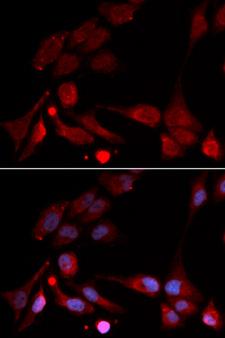APBB1 / FE65 Antibody - Immunofluorescence analysis of U20S cell using APBB1 antibody. Blue: DAPI for nuclear staining.