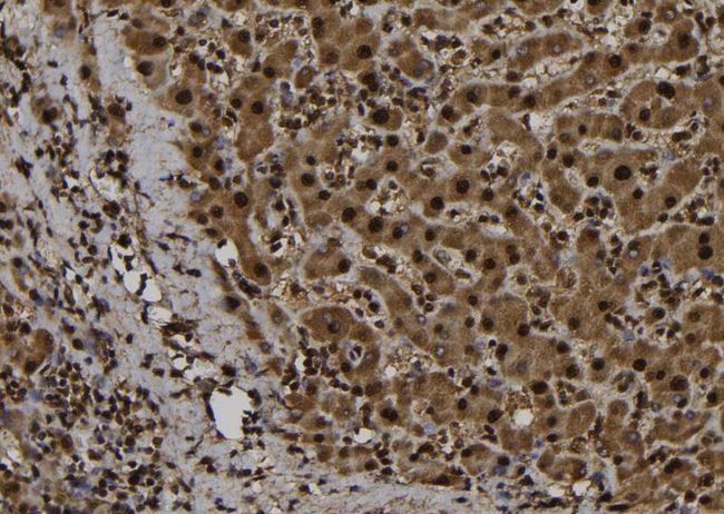 APBB1 / FE65 Antibody - 1:100 staining human liver tissue by IHC-P. The sample was formaldehyde fixed and a heat mediated antigen retrieval step in citrate buffer was performed. The sample was then blocked and incubated with the antibody for 1.5 hours at 22°C. An HRP conjugated goat anti-rabbit antibody was used as the secondary.