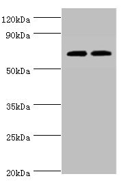 APBB1IP / RIAM Antibody - Western blot All lanes: APBB1IP antibody at 4µg/ml Lane 1: HL60 whole cell lysate Lane 2: Rat spleen tissue Secondary Goat polyclonal to rabbit IgG at 1/10000 dilution Predicted band size: 74, 19 kDa Observed band size: 74 kDa