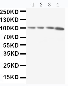 APBB1IP / RIAM Antibody - WB of APBB1IP / RIAM antibody. Lane 1: Rat Thymus Tissue Lysate. Lane 2: Rat Spleen Tissue Lysate. Lane 3: Rat RAJI Tissue Lysate. Lane 4: HL-60 Cell Lysate.