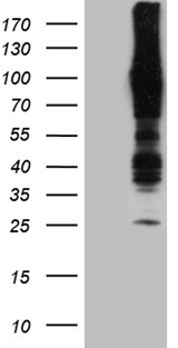APBB1IP / RIAM Antibody - HEK293T cells were transfected with the pCMV6-ENTRY control. (Left lane) or pCMV6-ENTRY APBB1IP. (Right lane) cDNA for 48 hrs and lysed. Equivalent amounts of cell lysates. (5 ug per lane) were separated by SDS-PAGE and immunoblotted with anti-APBB1IP. (1:2000)