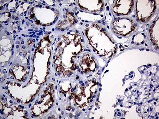 APBB1IP / RIAM Antibody - Immunohistochemical staining of paraffin-embedded Human Kidney tissue within the normal limits using anti-APBB1IP mouse monoclonal antibody. (Heat-induced epitope retrieval by 1mM EDTA in 10mM Tris buffer. (pH8.5) at 120°C for 3 min. (1:250)