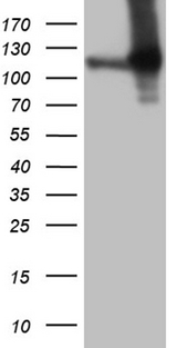 APBB1IP / RIAM Antibody - HEK293T cells were transfected with the pCMV6-ENTRY control. (Left lane) or pCMV6-ENTRY APBB1IP. (Right lane) cDNA for 48 hrs and lysed