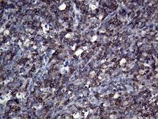 APBB1IP / RIAM Antibody - Immunohistochemical staining of paraffin-embedded Human lymph node tissue within the normal limits using anti-APBB1IP mouse monoclonal antibody. (Heat-induced epitope retrieval by 1mM EDTA in 10mM Tris buffer. (pH8.5) at 120°C for 3 min. (1:500)(1:250)