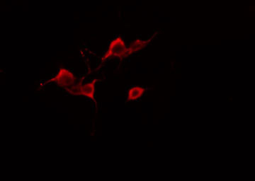APBB1IP / RIAM Antibody - Staining A549 cells by IF/ICC. The samples were fixed with PFA and permeabilized in 0.1% Triton X-100, then blocked in 10% serum for 45 min at 25°C. The primary antibody was diluted at 1:200 and incubated with the sample for 1 hour at 37°C. An Alexa Fluor 594 conjugated goat anti-rabbit IgG (H+L) antibody, diluted at 1/600, was used as secondary antibody.