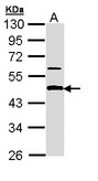 APBB3 Antibody - Sample (30 ug of whole cell lysate). A: A431 . 10% SDS PAGE. APBB3 antibody diluted at 1:1000.