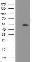 APBB3 Antibody - HEK293T cells were transfected with the pCMV6-ENTRY control (Left lane) or pCMV6-ENTRY APBB3 (Right lane) cDNA for 48 hrs and lysed. Equivalent amounts of cell lysates (5 ug per lane) were separated by SDS-PAGE and immunoblotted with anti-APBB3.