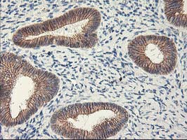 APBB3 Antibody - IHC of paraffin-embedded Human endometrium tissue using anti-APBB3 mouse monoclonal antibody.