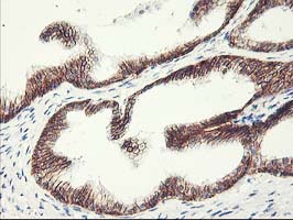 APBB3 Antibody - IHC of paraffin-embedded Human prostate tissue using anti-APBB3 mouse monoclonal antibody.