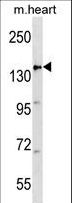 APC Antibody - APC Antibody western blot of mouse heart tissue lysates (35 ug/lane). The APC antibody detected the APC protein (arrow).