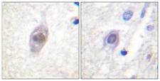APC Antibody - Immunohistochemistry analysis of paraffin-embedded human brain, using APC Antibody. The picture on the right is blocked with the synthesized peptide.