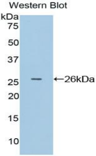APC Antibody - Western blot of recombinant APC.  This image was taken for the unconjugated form of this product. Other forms have not been tested.