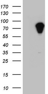APC Antibody - Human recombinant protein fragment corresponding to amino acids 955-1382 of human APC (NP_001120983) produced in E.coli.
