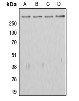 APC Antibody - Western blot analysis of APC expression in HeLa (A); HEK293T (B); SW480 (C); rat testis (D) whole cell lysates.