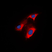 APC Antibody - Immunofluorescent analysis of APC staining in HeLa cells. Formalin-fixed cells were permeabilized with 0.1% Triton X-100 in TBS for 5-10 minutes and blocked with 3% BSA-PBS for 30 minutes at room temperature. Cells were probed with the primary antibody in 3% BSA-PBS and incubated overnight at 4 C in a humidified chamber. Cells were washed with PBST and incubated with a DyLight 594-conjugated secondary antibody (red) in PBS at room temperature in the dark. DAPI was used to stain the cell nuclei (blue).