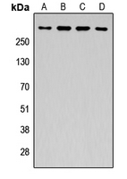 APC Antibody - Western blot analysis of APC expression in HeLa (A); A431 (B); NIH3T3 (C); H9C2 (D) whole cell lysates.