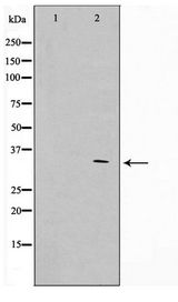 APC Antibody - Western blot of HUVEC cell lysate using APC Antibody