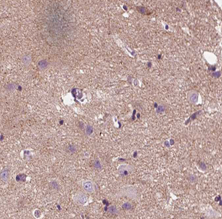APC Antibody - 1:100 staining human brain tissue by IHC-P. The tissue was formaldehyde fixed and a heat mediated antigen retrieval step in citrate buffer was performed. The tissue was then blocked and incubated with the antibody for 1.5 hours at 22°C. An HRP conjugated goat anti-rabbit antibody was used as the secondary.