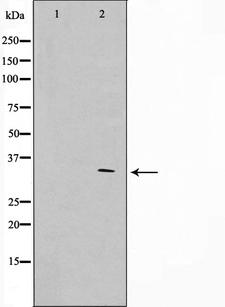 APC Antibody - Western blot analysis on HuvEc cell lysates using APC antibody. The lane on the left is treated with the antigen-specific peptide.
