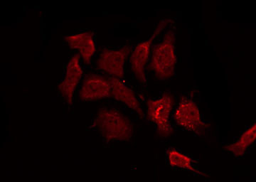 APC Antibody - Staining HuvEc cells by IF/ICC. The samples were fixed with PFA and permeabilized in 0.1% Triton X-100, then blocked in 10% serum for 45 min at 25°C. The primary antibody was diluted at 1:200 and incubated with the sample for 1 hour at 37°C. An Alexa Fluor 594 conjugated goat anti-rabbit IgG (H+L) Ab, diluted at 1/600, was used as the secondary antibody.