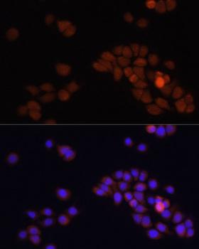 APC Antibody - Immunofluorescence analysis of HT29 cells using APC Polyclonal Antibody at dilution of 1:100.Blue: DAPI for nuclear staining.
