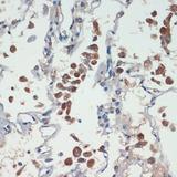 APC Antibody - Immunohistochemistry of paraffin-embedded Human lung using APC Polyclonal Antibody at dilution of 1:200 (40x lens).