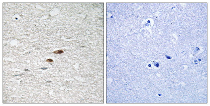APC Antibody - Immunohistochemistry analysis of paraffin-embedded human brain, using APC (Phospho-Ser2054) Antibody. The picture on the right is blocked with the phospho peptide.