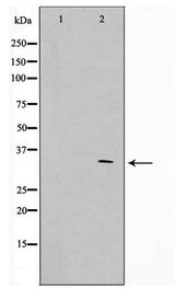 APC Antibody - Western blot of HUVEC cell lysate using Phospho-APC(Ser2054) Antibody