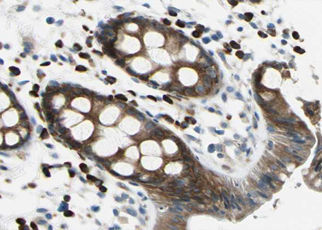 APC Antibody - 1:100 staining human Rectum tissue by IHC-P. The tissue was formaldehyde fixed and a heat mediated antigen retrieval step in citrate buffer was performed. The tissue was then blocked and incubated with the antibody for 1.5 hours at 22°C. An HRP conjugated goat anti-rabbit antibody was used as the secondary.
