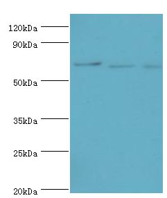 APC6 / CDC16 Antibody - Western blot. All lanes: Cell division cycle protein 16 homolog antibody at 4 ug/ml. Lane 1: Jurkat whole cell lysate. Lane 2: HeLa whole CLL lysate. Lane 3: k562 whole cell lysate. secondary Goat polyclonal to rabbit at 1:10000 dilution. Predicted band size: 72 kDa. Observed band size: 72 kDa.