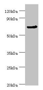 APC6 / CDC16 Antibody - Western blot All lanes: CDC16 antibody at 4µg/ml + Jurkat whole cell lysate Secondary Goat polyclonal to rabbit IgG at 1/10000 dilution Predicted band size: 72, 66, 61 kDa Observed band size: 72 kDa