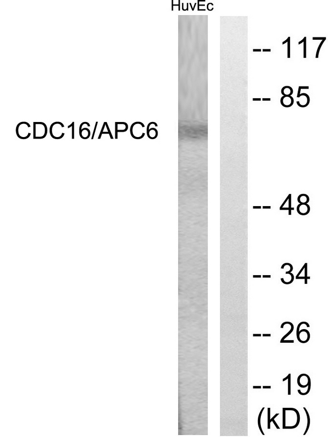 APC6 / CDC16 Antibody - Western blot analysis of lysates from HUVEC cells, using CDC16/APC6 Antibody. The lane on the right is blocked with the synthesized peptide.