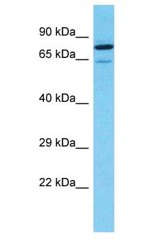 APC6 / CDC16 Antibody - APC6 / CDC16 antibody Western Blot of 786-0. Antibody dilution: 1 ug/ml.  This image was taken for the unconjugated form of this product. Other forms have not been tested.