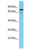 APC6 / CDC16 Antibody - APC6 / CDC16 antibody Western Blot of 786-0. Antibody dilution: 1 ug/ml.  This image was taken for the unconjugated form of this product. Other forms have not been tested.