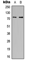 APC6 / CDC16 Antibody - Western blot analysis of CDC16 expression in HeLa (A); HT1080 (B) whole cell lysates.