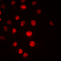APC6 / CDC16 Antibody - Immunofluorescent analysis of CDC16 staining in HeLa cells. Formalin-fixed cells were permeabilized with 0.1% Triton X-100 in TBS for 5-10 minutes and blocked with 3% BSA-PBS for 30 minutes at room temperature. Cells were probed with the primary antibody in 3% BSA-PBS and incubated overnight at 4 C in a humidified chamber. Cells were washed with PBST and incubated with a DyLight 594-conjugated secondary antibody (red) in PBS at room temperature in the dark. DAPI was used to stain the cell nuclei (blue).