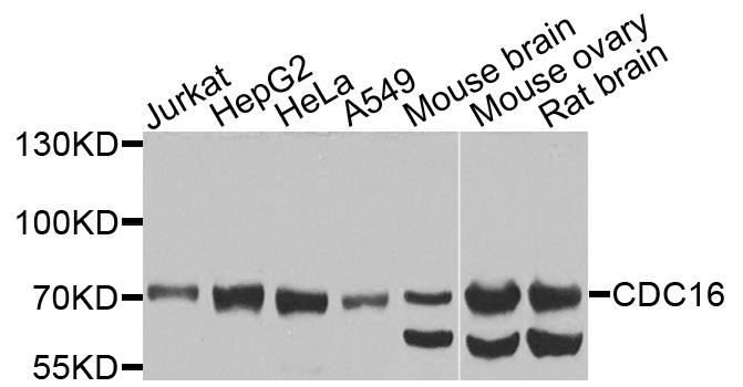 APC6 / CDC16 Antibody - Western blot analysis of extracts of various cells.