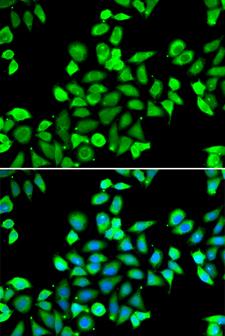 APC6 / CDC16 Antibody - Immunofluorescence analysis of A549 cells.
