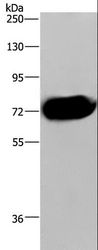 APC6 / CDC16 Antibody - Western blot analysis of Human pancreas tissue, using CDC16 Polyclonal Antibody at dilution of 1:250.