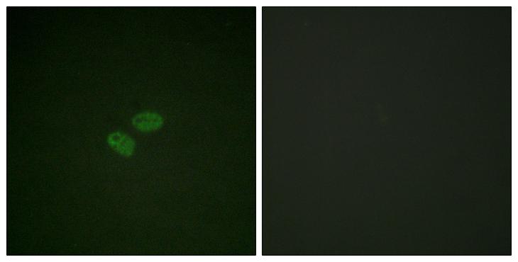 APC6 / CDC16 Antibody - Peptide - + Immunofluorescence analysis of HeLa cells, using CDC16/APC6 (Ab-560) antibody.