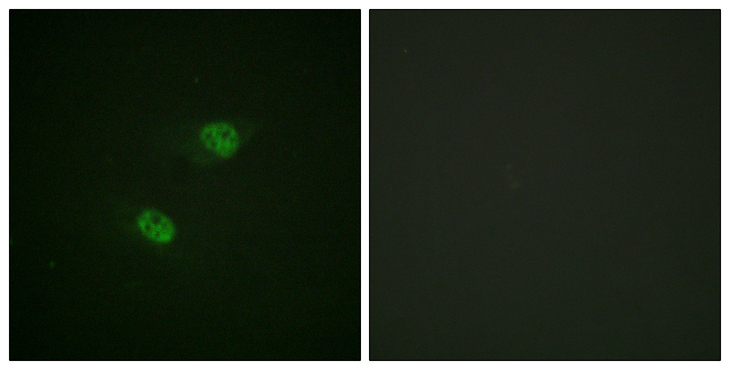 APC6 / CDC16 Antibody - Immunofluorescence analysis of HeLa cells, using CDC16/APC6 (Phospho-Ser560) Antibody. The picture on the right is blocked with the phospho peptide.