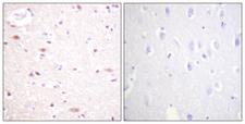 APC6 / CDC16 Antibody - Immunohistochemistry analysis of paraffin-embedded human brain, using CDC16/APC6 (Phospho-Ser560) Antibody. The picture on the right is blocked with the phospho peptide.