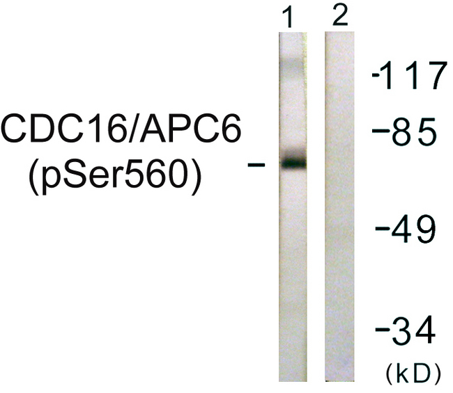 APC6 / CDC16 Antibody - Western blot analysis of lysates from HUVEC cells, using CDC16/APC6 (Phospho-Ser560) Antibody. The lane on the right is blocked with the phospho peptide.