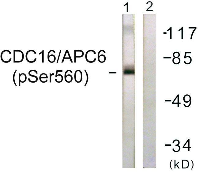 APC6 / CDC16 Antibody - Western blot analysis of extracts from HuvEc cells, using CDC16/APC6 (Phospho-Ser560) antibody.