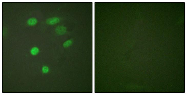 APC6 / CDC16 Antibody - P-peptide - + Immunofluorescence analysis of HeLa cells, using CDC16/APC6 (Phospho-Ser560) antibody.