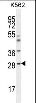 APCS / Serum Amyloid P / SAP Antibody - APCS Antibody western blot of K562 cell line lysates (35 ug/lane). The APCS antibody detected the APCS protein (arrow).