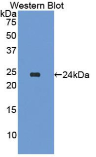 APCS / Serum Amyloid P / SAP Antibody - Western blot of recombinant APCS / Serum Amyloid P / SAP.  This image was taken for the unconjugated form of this product. Other forms have not been tested.