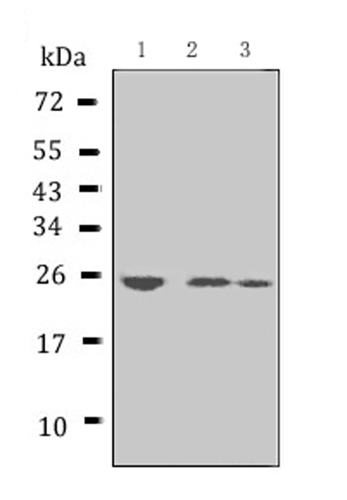 APCS / Serum Amyloid P / SAP Antibody - Western blot analysis of Serum Amyloid P using anti-Serum Amyloid P antibody (PB902). Electrophoresis was performed on a 5-20% SDS-PAGE gel at 70V (Stacking gel) / 90V (Resolving gel) for 2-3 hours. The sample well of each lane was loaded with 50ug of sample under reducing conditions. Lane 1: mouse liver tissue lysates, Lane 2: mouse ovary tissue lysates, Lane 3: mouse testis tissue lysates. After Electrophoresis, proteins were transferred to a Nitrocellulose membrane at 150mA for 50-90 minutes. Blocked the membrane with 5% Non-fat Milk/ TBS for 1.5 hour at RT. The membrane was incubated with rabbit anti-Serum Amyloid P antigen affinity purified polyclonal antibody (Catalog # PB902) at 0.5 µg/mL overnight at 4°C, then washed with TBS-0.1% Tween 3 times with 5 minutes each and probed with a goat anti-rabbit IgG-HRP secondary antibody at a dilution of 1:10000 for 1.5 hour at RT. The signal is developed using an Enhanced Chemiluminescent detection (ECL) kit with Tanon 5200 system. A specific band was detected for Serum Amyloid P at approximately 25KD. The expected band size for Serum Amyloid P is at 25KD.