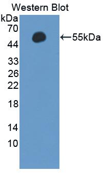 APCS / Serum Amyloid P / SAP Antibody - Western blot of APCS / Serum Amyloid P / SAP antibody.